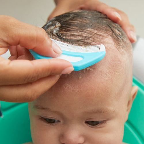 Frida Baby DermaFrida the Flake Fixer